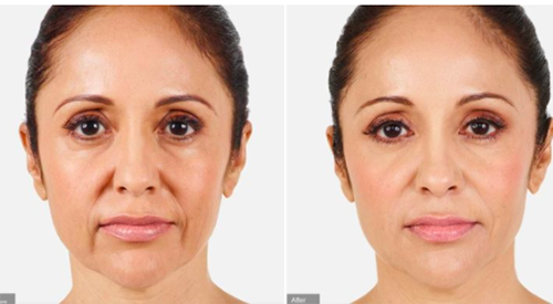 Screen Shot B&A Filler 2021-09-30